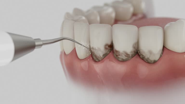 Reliable Dental contractor in Kinder, LA by Smile Center Dentistry